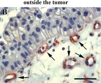 Anti-Mouse IgG (whole molecule)–Peroxidase antibody produced in goat affinity isolated antibody, buffered aqueous solution
