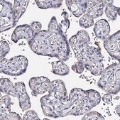 Anti-DNAH6 antibody produced in rabbit Prestige Antibodies® Powered by Atlas Antibodies, affinity isolated antibody, buffered aqueous glycerol solution