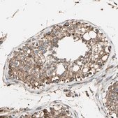 Anti-MRPS22 antibody produced in rabbit Prestige Antibodies® Powered by Atlas Antibodies, affinity isolated antibody, buffered aqueous glycerol solution