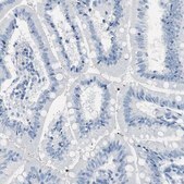 Anti-MUC7 antibody produced in rabbit Prestige Antibodies® Powered by Atlas Antibodies, affinity isolated antibody, buffered aqueous glycerol solution