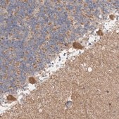 Anti-C17orf53 antibody produced in rabbit Prestige Antibodies® Powered by Atlas Antibodies, affinity isolated antibody, buffered aqueous glycerol solution, Ab2