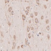Anti-PREX1 antibody produced in rabbit Prestige Antibodies® Powered by Atlas Antibodies, affinity isolated antibody, buffered aqueous glycerol solution
