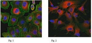Anti-Protein Gene Product 9.5 Antibody from rabbit, purified by affinity chromatography
