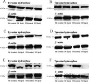 Anti-Tyrosine Hydroxylase Antibody, clone LNC1 ascites fluid, clone LNC1, Chemicon®