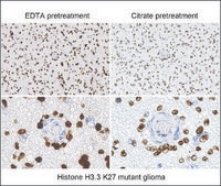 Anti-Histone H3 K27M antibody, Rabbit Monoclonal recombinant, expressed in HEK 293 cells, clone RM192, purified immunoglobulin