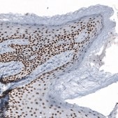 Anti-GRHL2 antibody produced in rabbit Prestige Antibodies® Powered by Atlas Antibodies, affinity isolated antibody, buffered aqueous glycerol solution