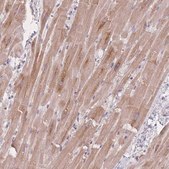 Anti-MRPS14 antibody produced in rabbit Prestige Antibodies® Powered by Atlas Antibodies, affinity isolated antibody, buffered aqueous glycerol solution