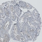 Anti-RSPH9 antibody produced in rabbit Prestige Antibodies® Powered by Atlas Antibodies, affinity isolated antibody, buffered aqueous glycerol solution