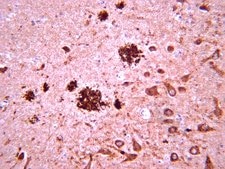 Anti-Amyloid β Antibody, clone W0-2 clone WO2, from mouse