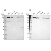 抗PITRM1抗体 ウサギ宿主抗体 Ab1, Prestige Antibodies® Powered by Atlas Antibodies, affinity isolated antibody, buffered aqueous glycerol solution