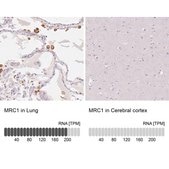 Anti-MRC1 antibody produced in rabbit Prestige Antibodies® Powered by Atlas Antibodies, affinity isolated antibody, buffered aqueous glycerol solution
