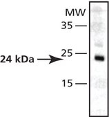 Anti-Superoxide Dismutase (MnSOD) (DD-17) antibody produced in rabbit affinity isolated antibody, buffered aqueous solution