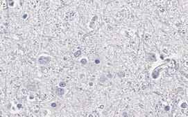 抗Olig2抗体 クローン211F1.1 ZooMAb® マウス・モノクローナル recombinant, expressed in HEK 293 cells