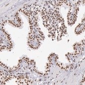 Anti-HNRNPH2 antibody produced in rabbit Ab1, Prestige Antibodies® Powered by Atlas Antibodies, affinity isolated antibody, buffered aqueous glycerol solution