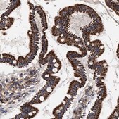 Anti-COG5 antibody produced in rabbit Prestige Antibodies® Powered by Atlas Antibodies, affinity isolated antibody, buffered aqueous glycerol solution