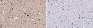 Anti-PTEN Antibody, clone A2b1 ZooMAb® Mouse Monoclonal recombinant, expressed in HEK 293 cells