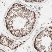 Anti-TOMM22 antibody produced in rabbit affinity isolated antibody, buffered aqueous glycerol solution