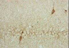 Anti-Glutamate Decarboxylase Antibody, 65 kDa isoform, clone GAD-6 clone GAD-6, Chemicon®, from mouse