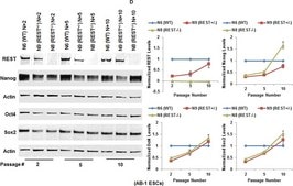 Anti-REST Antibody Upstate®, from rabbit