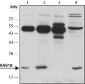 Anti-Rab18 antibody produced in rabbit ~1.0 mg/mL, affinity isolated antibody