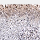 Anti-ATF3 antibody produced in rabbit Prestige Antibodies® Powered by Atlas Antibodies, affinity isolated antibody, buffered aqueous glycerol solution
