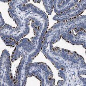 Anti-RINT1 antibody produced in rabbit Prestige Antibodies® Powered by Atlas Antibodies, affinity isolated antibody, buffered aqueous glycerol solution