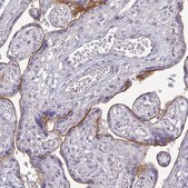 Monoclonal Anti-HER2 antibody produced in mouse Prestige Antibodies® Powered by Atlas Antibodies, clone CL0268, purified immunoglobulin, buffered aqueous glycerol solution