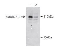 Anti-SMARCAL1 Antibody serum, from rabbit