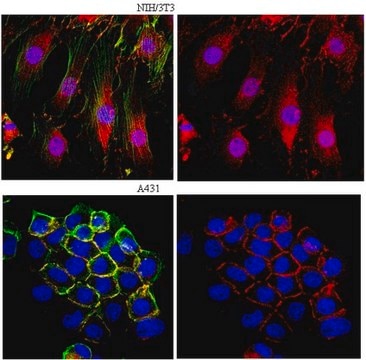 Anti-β-Catenin Antibody from rabbit, purified by affinity chromatography