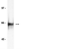 Anti-HDAC1 Antibody Upstate®, from rabbit