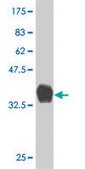 Monoclonal Anti-KRAS antibody produced in mouse clone 4F3, purified immunoglobulin, buffered aqueous solution