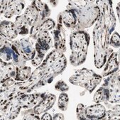 Anti-FBXO44 antibody produced in rabbit Prestige Antibodies® Powered by Atlas Antibodies, affinity isolated antibody, buffered aqueous glycerol solution