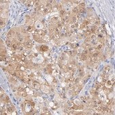 Anti-ARG1 antibody produced in rabbit Prestige Antibodies® Powered by Atlas Antibodies, affinity isolated antibody, buffered aqueous glycerol solution
