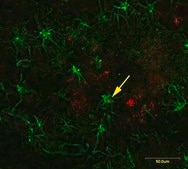 Anti-Amyloid Oligomer Antibody, αβ, oligomeric serum, Chemicon®