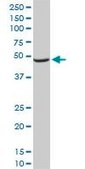 Monoclonal Anti-NDUFA9 antibody produced in mouse clone 3D7, purified immunoglobulin, buffered aqueous solution