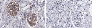 Anti-Vimentin Antibody, clone 2I13 ZooMAb® Rabbit Monoclonal recombinant, expressed in HEK 293 cells