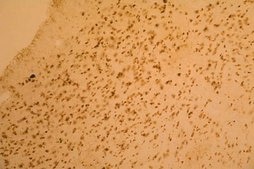 Anti-Synuclein α Antibody, clone 7B12.2 culture supernatant, clone 7B12.2, Chemicon®