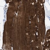 Anti-DES antibody produced in rabbit Prestige Antibodies® Powered by Atlas Antibodies, affinity isolated antibody, buffered aqueous glycerol solution