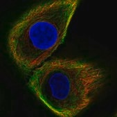 Anti-KRT17 antibody produced in rabbit Ab1, Prestige Antibodies® Powered by Atlas Antibodies, affinity isolated antibody, buffered aqueous glycerol solution