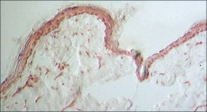 モノクロナール抗コラーゲン, III型 マウス宿主抗体 clone FH-7A, ascites fluid