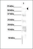 Anti-NR4A2 (AB2) antibody produced in rabbit affinity isolated antibody