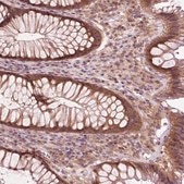 Anti-CNOT2 antibody produced in rabbit Prestige Antibodies® Powered by Atlas Antibodies, affinity isolated antibody