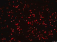 CR4 Human Colorectal Cancer Cell Line CR4 is a unique, cancer stem cell (CSC) enriched, human colorectal cancer cell line useful for CSC-targeted drug development and research focused on cancer cell and CSC biology.