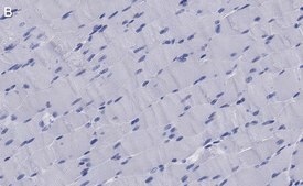 Anti-Dystrophin Antibody, clone 1G7, ZooMAb® Rabbit Monoclonal recombinant, expressed in HEK 293 cells
