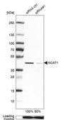 抗ACAT1抗体 ウサギ宿主抗体 Ab1, Prestige Antibodies® Powered by Atlas Antibodies, affinity isolated antibody, buffered aqueous glycerol solution