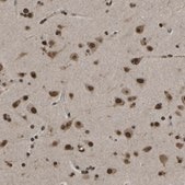 Anti-SPEN antibody produced in rabbit Prestige Antibodies® Powered by Atlas Antibodies, affinity isolated antibody, buffered aqueous glycerol solution