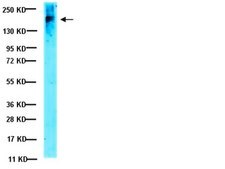 Anti-CFTR Antibody, clone MM13-4 clone MM13-4, Upstate®, from mouse