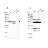 Anti-GRSF1 antibody produced in rabbit Prestige Antibodies® Powered by Atlas Antibodies, affinity isolated antibody, buffered aqueous glycerol solution