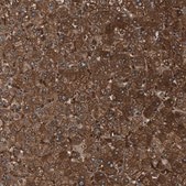 Anti-FBP1 antibody produced in rabbit Prestige Antibodies® Powered by Atlas Antibodies, affinity isolated antibody, buffered aqueous glycerol solution