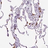 Anti-CD68 antibody produced in rabbit Prestige Antibodies® Powered by Atlas Antibodies, affinity isolated antibody, buffered aqueous glycerol solution